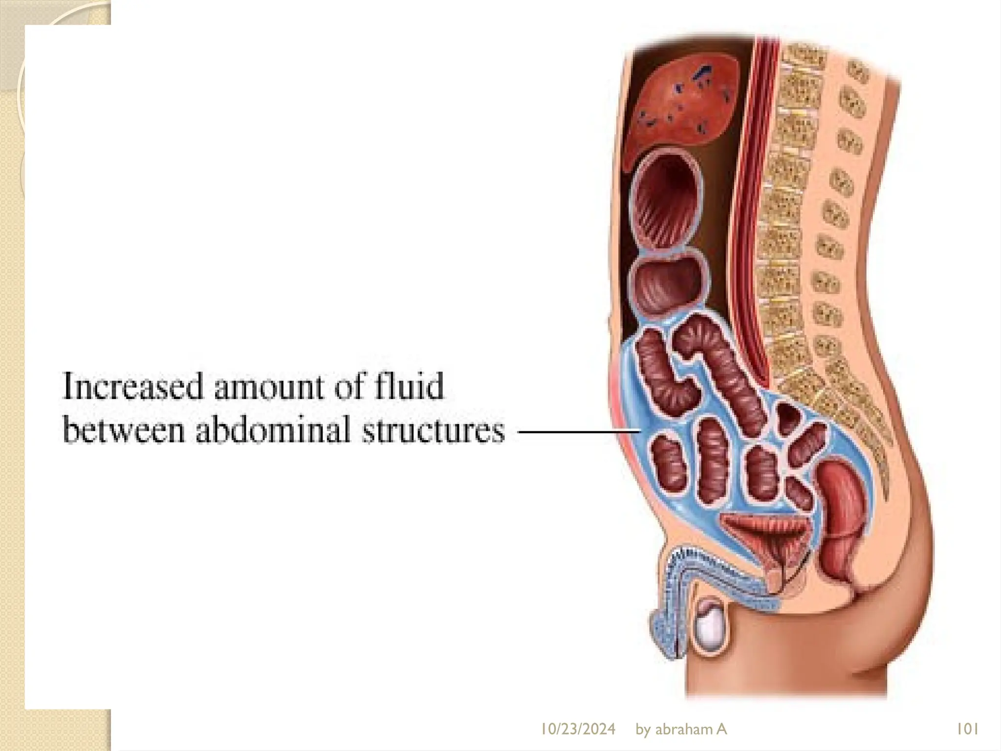 10/23/2024 by abraham A 101
 