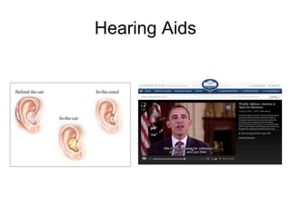 Hearing Aids 
 