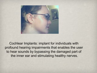 Cochlear Implants: implant for individuals with
profound hearing impairments that enables the user
to hear sounds by bypassing the damaged part of
the inner ear and stimulating healthy nerves.
 