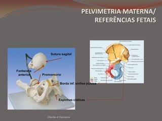  Apresentação pélvica