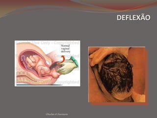  Doenças auto-imunes, trombofilias, 