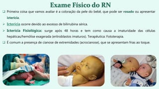  Primeira coisa que vamos avaliar é a coloração da pele do bebê, que pode ser rosado ou apresentar
icterícia.
 Icterícia ocorre devido ao excesso de bilirrubina sérica.
 Icterícia Fisiológica: surge após 48 horas e tem como causa a imaturidade das células
hepáticas/hemólise exagerada (eritroblastos imaturos). Terapêutica: Fototerapia.
 É comum a presença de cianose de extremidades (acrocianose), que se apresentam frias ao toque.
 