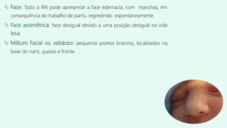  Face: Todo o RN pode apresentar a face edemacia, com manchas, em
consequência do trabalho de parto, regredindo espontaneamente.
 Face assimétrica: face desigual devido a uma posição desigual na vida
fetal.
 Millium Facial ou sebáceo: pequenos pontos brancos, localizados na
base do nariz, queixo e fronte.
 
