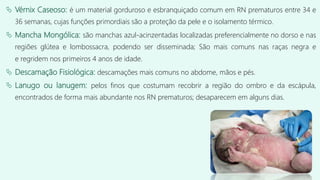  Vérnix Caseoso: é um material gorduroso e esbranquiçado comum em RN prematuros entre 34 e
36 semanas, cujas funções primordiais são a proteção da pele e o isolamento térmico.
 Mancha Mongólica: são manchas azul-acinzentadas localizadas preferencialmente no dorso e nas
regiões glútea e lombossacra, podendo ser disseminada; São mais comuns nas raças negra e
e regridem nos primeiros 4 anos de idade.
 Descamação Fisiológica: descamações mais comuns no abdome, mãos e pés.
 Lanugo ou lanugem: pelos finos que costumam recobrir a região do ombro e da escápula,
encontrados de forma mais abundante nos RN prematuros; desaparecem em alguns dias.
 