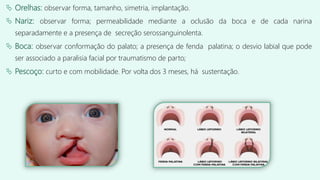  Orelhas: observar forma, tamanho, simetria, implantação.
 Nariz: observar forma; permeabilidade mediante a oclusão da boca e de cada narina
separadamente e a presença de secreção serossanguinolenta.
 Boca: observar conformação do palato; a presença de fenda palatina; o desvio labial que pode
ser associado a paralisia facial por traumatismo de parto;
 Pescoço: curto e com mobilidade. Por volta dos 3 meses, há sustentação.
 