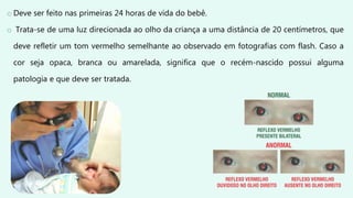 o Deve ser feito nas primeiras 24 horas de vida do bebê.
o Trata-se de uma luz direcionada ao olho da criança a uma distância de 20 centímetros, que
deve refletir um tom vermelho semelhante ao observado em fotografias com flash. Caso a
cor seja opaca, branca ou amarelada, significa que o recém-nascido possui alguma
patologia e que deve ser tratada.
 