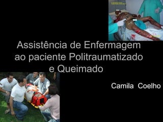 Assistência de EnfermagemAssistência de Enfermagem
ao paciente Politraumatizadoao paciente Politraumatizado
e Queimadoe Queimado
Camila CoelhoCamila Coelho
 