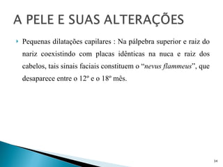Pequenas dilatações capilares : Na pálpebra superior e raiz do nariz coexistindo com placas idênticas na nuca e raiz dos cabelos, tais sinais faciais constituem o “ nevus flammeus ”, que desaparece entre o 12º e o 18º mês. 