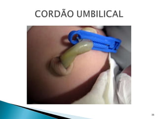 Assistência de enfermagem em neonatologia
