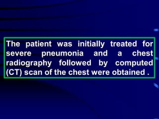 The patient was initially treated for
severe pneumonia and a chest
radiography followed by computed
(CT) scan of the chest were obtained .
 