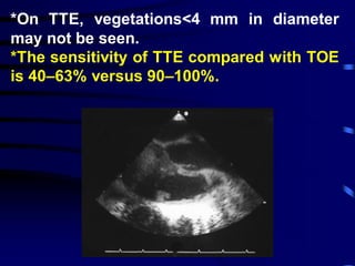 *On TTE, vegetations<4 mm in diameter
may not be seen.
*The sensitivity of TTE compared with TOE
is 40–63% versus 90–100%.
 