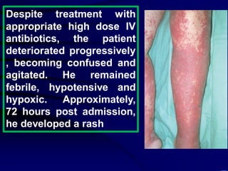 Despite treatment with
appropriate high dose IV
antibiotics, the patient
deteriorated progressively
, becoming confused and
agitated. He remained
febrile, hypotensive and
hypoxic. Approximately,
72 hours post admission,
he developed a rash
 