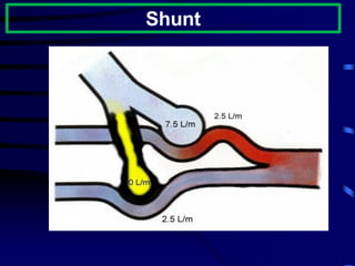 Shunt
 
