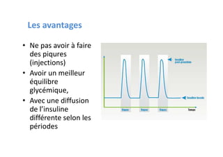 Les avantages

• Ne pas avoir à faire
  des piqures
  (injections)
• Avoir un meilleur
  équilibre
  glycémique,
• Avec une diffusion
  de l’insuline
  différente selon les
  périodes
 