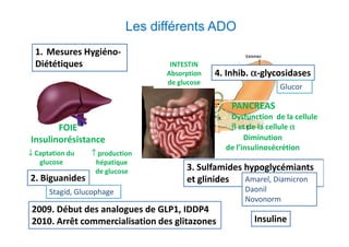 Les différents ADO
  1. Mesures Hygiéno-
  Diététiques                     INTESTIN
                                 Absorption   4. Inhib. α-glycosidases
                                 de glucose
                                                               Glucor

                                                  PANCREAS
                                                 Dysfunction de la cellule
       FOIE                                      β et de la cellule α
Insulinorésistance                                    Diminution
                                                de l’insulinosécrétion
↓ Captation du   ↑ production
   glucose        hépatique
                  de glucose          3. Sulfamides hypoglycémiants
2. Biguanides                         et glinides   Amarel, Diamicron
      Stagid, Glucophage                             Daonil
                                                     Novonorm
 2009. Début des analogues de GLP1, IDDP4
 2010. Arrêt commercialisation desde type 2
                          Diabète glitazones            Insuline
 