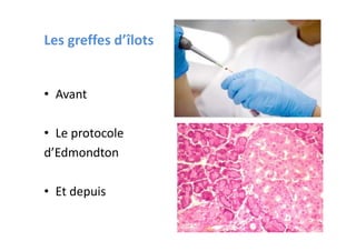 Les greffes d’îlots


• Avant

• Le protocole
d’Edmondton

• Et depuis
 