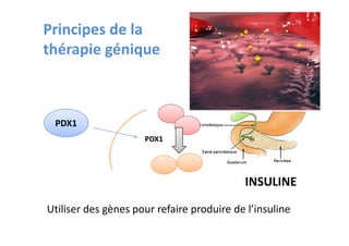 Principes de la
thérapie génique



 PDX1
                     PDX1




                                           INSULINE

Utiliser des gènes pour refaire produire de l’insuline
 