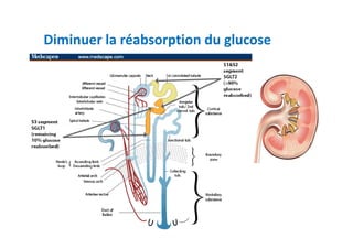 Diminuer la réabsorption du glucose



                            REIN
                            Réabsorption de
                            glucose

Inhibiteurs
Dapagliflozine 5 ou 10 mg         SGLT2
Empagliflozine


Baisse de 0,7 pt
Effet diurétique
Infections urinaires
 