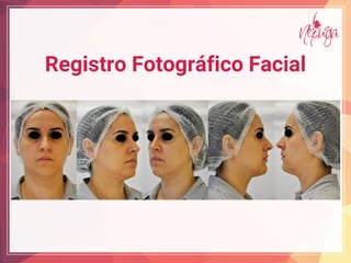Registro Fotográfico Facial
 