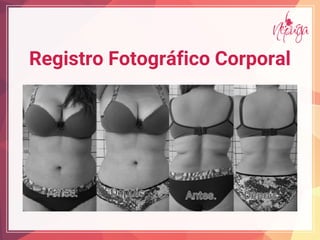 Registro Fotográfico Corporal
 