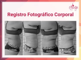 Registro Fotográfico Corporal
 