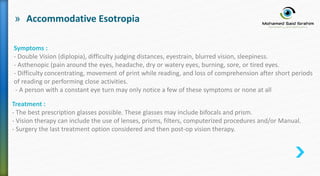 » Accommodative Esotropia
Symptoms :
- Double Vision (diplopia), difficulty judging distances, eyestrain, blurred vision, sleepiness.
- Asthenopic (pain around the eyes, headache, dry or watery eyes, burning, sore, or tired eyes.
- Difficulty concentrating, movement of print while reading, and loss of comprehension after short periods
of reading or performing close activities.
- A person with a constant eye turn may only notice a few of these symptoms or none at all
Treatment :
- The best prescription glasses possible. These glasses may include bifocals and prism.
- Vision therapy can include the use of lenses, prisms, filters, computerized procedures and/or Manual.
- Surgery the last treatment option considered and then post-op vision therapy.
 
