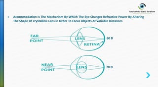 » Accommodation Is The Mechanism By Which The Eye Changes Refractive Power By Altering
The Shape Of crystalline Lens In Order To Focus Objects At Variable Distances
60 D
70 D
 