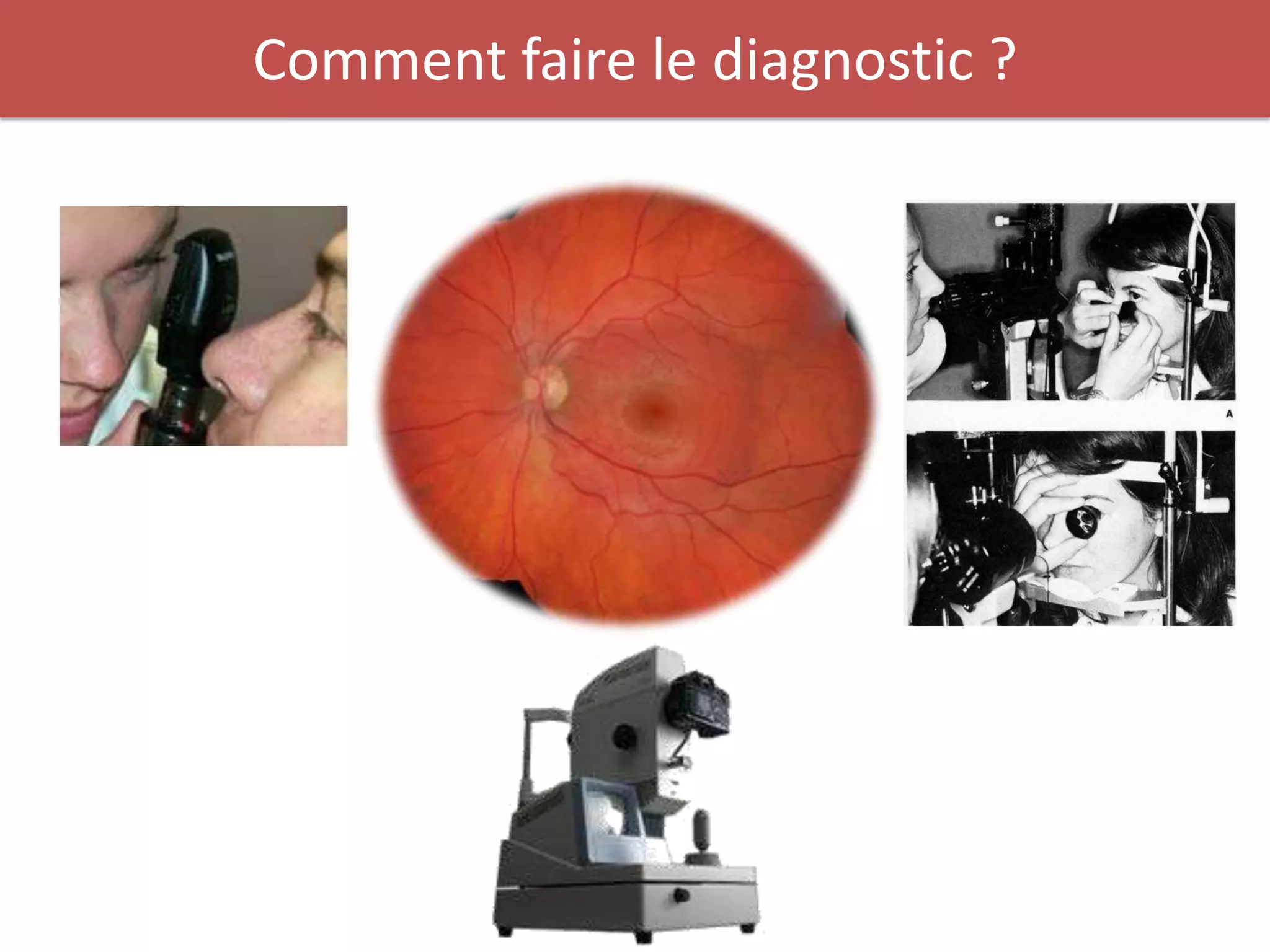 Comment faire le diagnostic ?
 
