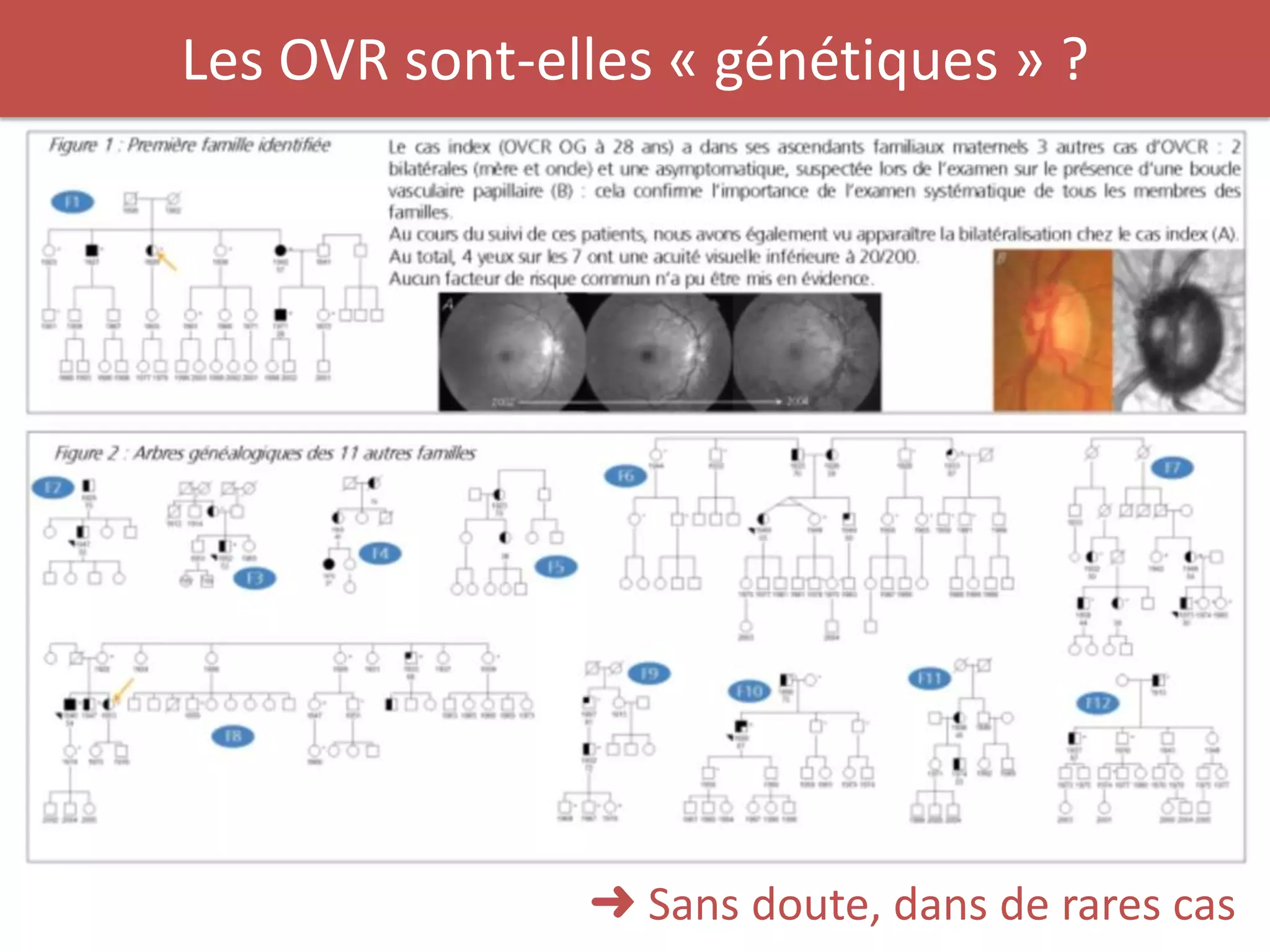 Les OVR sont-elles « génétiques » ?




               ➜ Sans doute, dans de rares cas
 