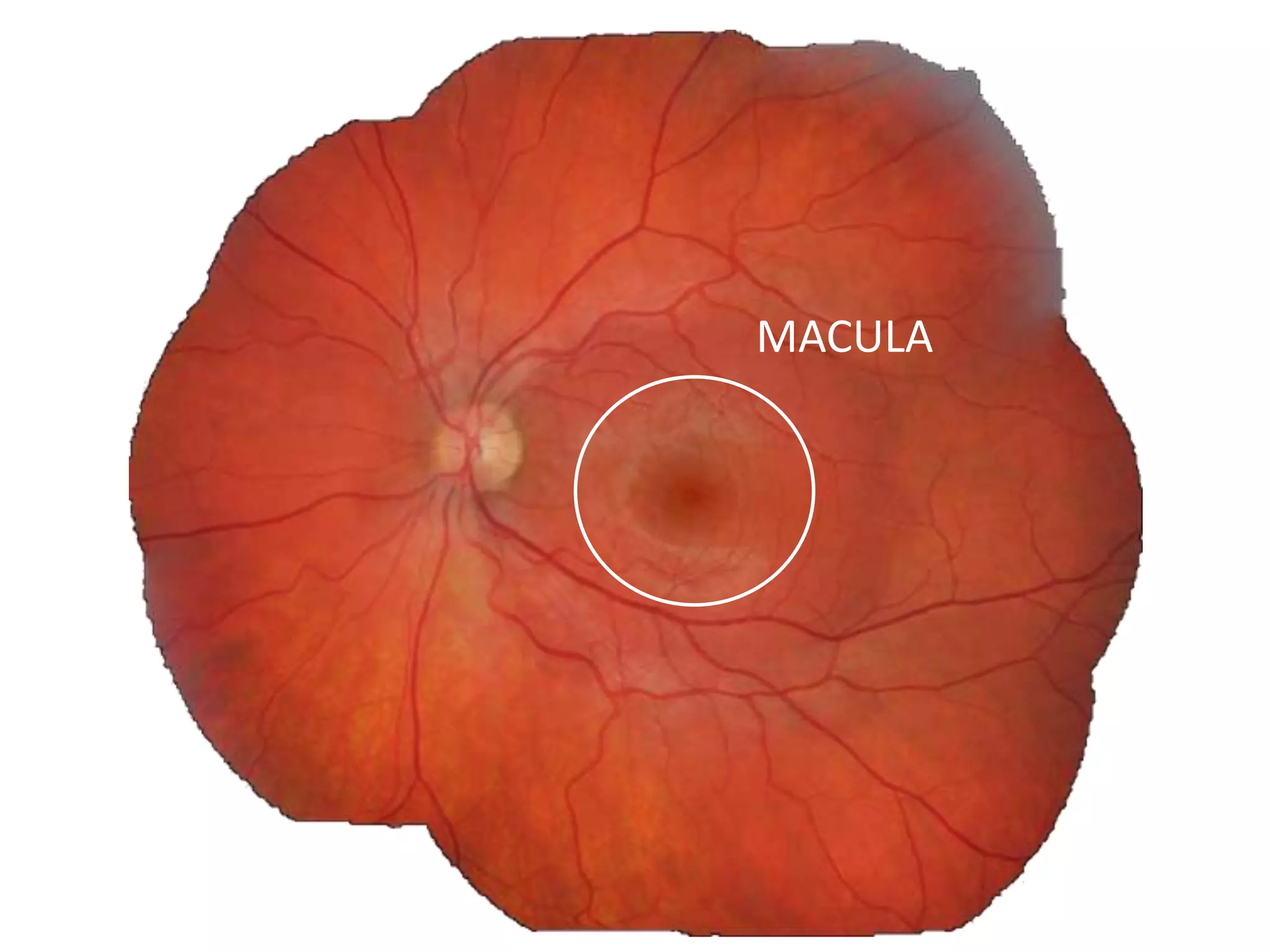 MACULA
 