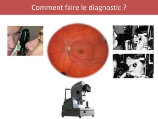 Comment faire le diagnostic ?
 