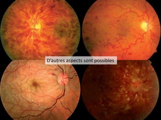 D’autres aspects sont possibles
 