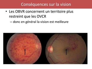 Conséquences sur la vision
• Les OBVR concernent un territoire plus
  restreint que les OVCR
  – donc en général la vision est meilleure
 