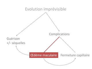 Evolution imprévisible




                          Complications
Guérison
+/- séquelles


                Œdème maculaire   Fermeture capillaire
 