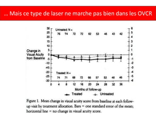 … Mais ce type de laser ne marche pas bien dans les OVCR
 