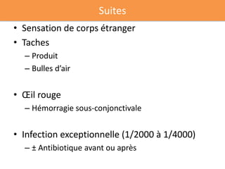 Suites
• Sensation de corps étranger
• Taches
  – Produit
  – Bulles d’air


• Œil rouge
  – Hémorragie sous-conjonctivale


• Infection exceptionnelle (1/2000 à 1/4000)
  – ± Antibiotique avant ou après
 