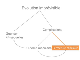 Evolution imprévisible




                           Complications
Guérison
+/- séquelles


                Œdème maculaire Fermeture capillaire
 
