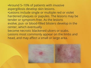 •Around 5–10% of patients with invasive
aspergillosis develop skin lesions.
•Lesions include single or multiple red or violet
hardened plaques or papules. The lesions may be
tender or symptom-free. As the lesions
evolve, pus- or blood-filled blisters develop in the
center, which eventually
become necrotic blackened ulcers or scabs.
Lesions most commonly appear on the limbs and
head, and may affect a small or large area.
 