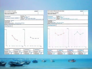 ASSR | PPTX
