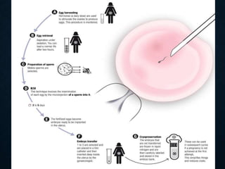 Asssisted reproductive techniques | PPTX
