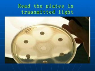 Read the plates in  traanmitted light 