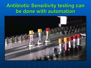Antibiotic Sensitivity testing can be done with automation 