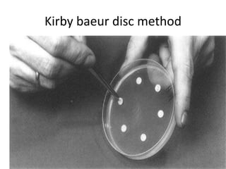 Kirby baeur disc method
 