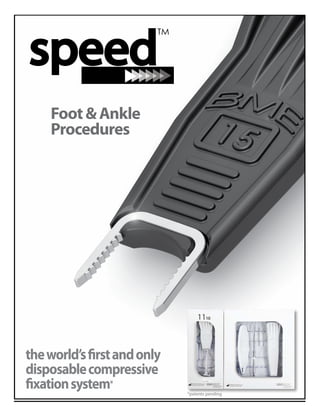 Technique Manual
Foot&Ankle
Procedures
theworld’sfirstandonly
disposablecompressive 	
fixationsystem*
*patents pending
 