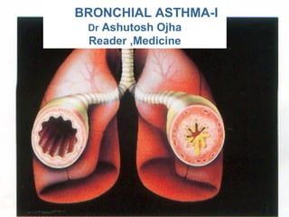 BRONCHIAL ASTHMA-I
Dr Ashutosh Ojha
Reader ,Medicine
 