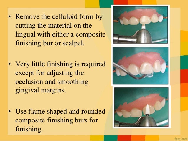Asthetic Crowns In Pediatric Dentistry