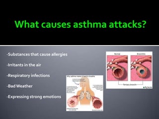 -Substances that cause allergies
-Irritants in the air
-Respiratory infections
-Bad Weather
-Expressing strong emotions