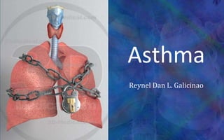 Asthma,[object Object],Reynel Dan L. Galicinao,[object Object]