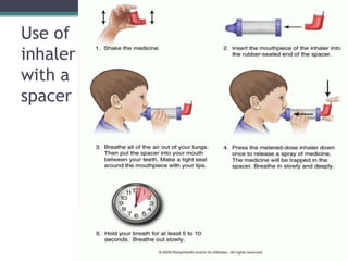 Use of
inhaler
with a
spacer
 