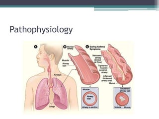 Pathophysiology
 